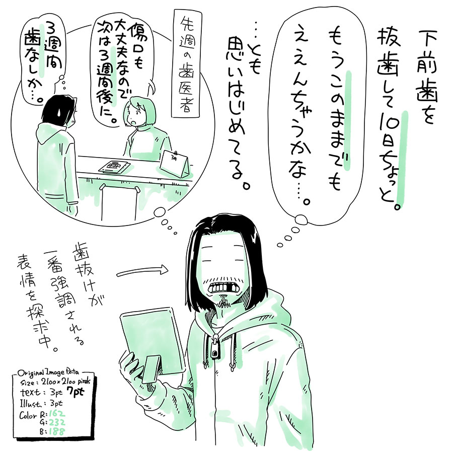 ユアサミズキのイラスト絵日記1コママンガ
おもしろ表情の探求の結果、
"上の前歯"が抜けてる以上には
おもしろくならない。
…という事が分かったよ。
抜いて1週間後に経過観察に
行ったから、4週間歯なしは確定。
ぐらついてた歯を抜いたので、
食事も歯磨きもベリー快適。